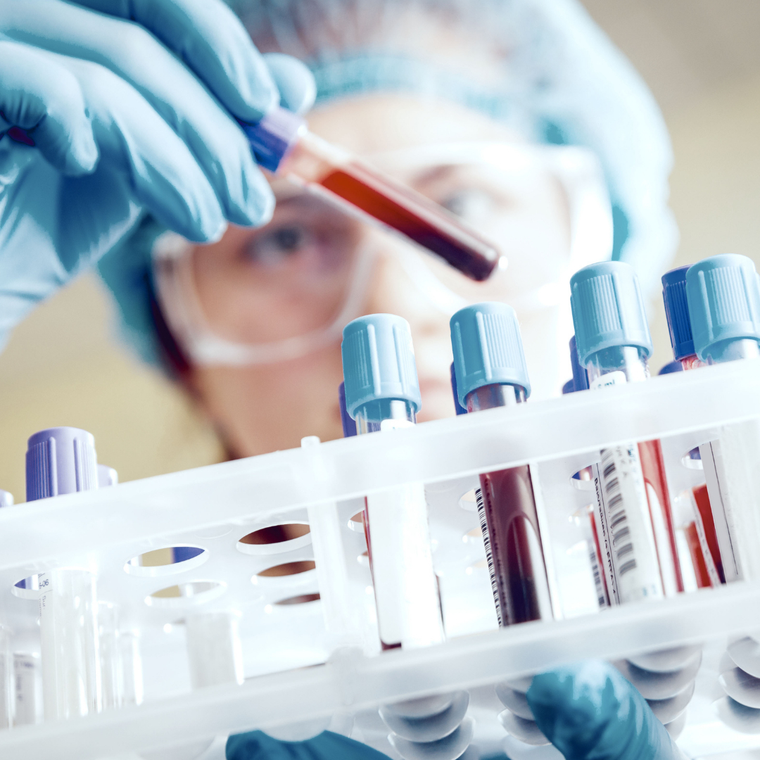 RGCC scientist analyzing a liquid biopsy test